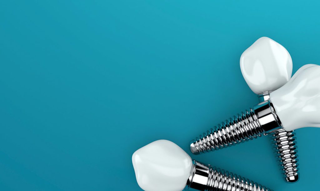 dental implant marketing specialists